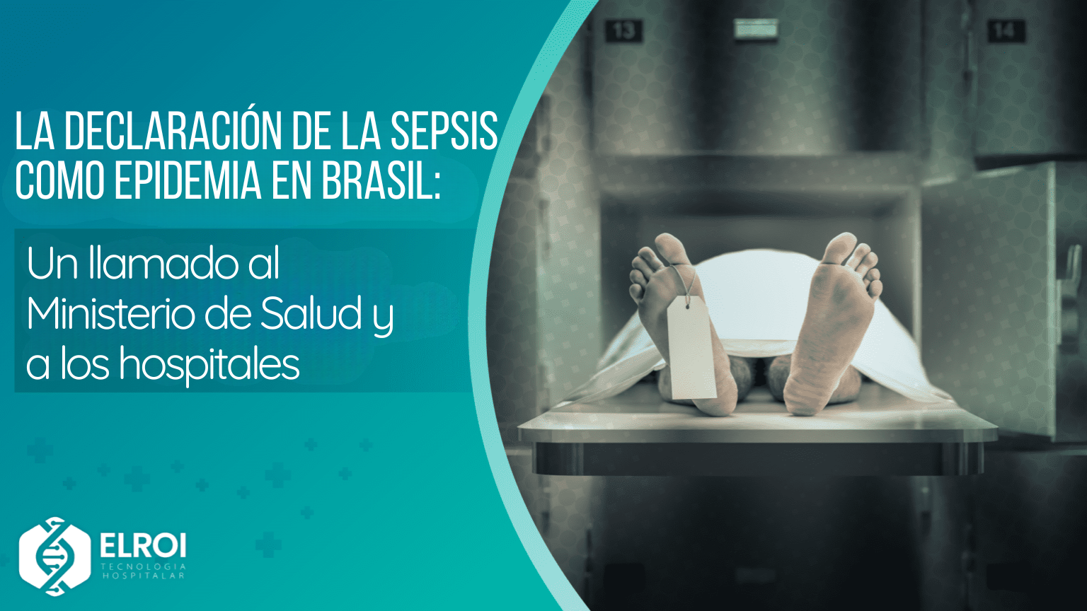 La declaración de la sepsis como epidemia en Brasil Elroi Medical